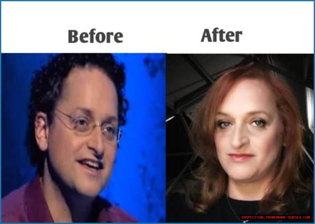 Dr. Lynette Nusbacher Before And After: A Journey Of Transformation