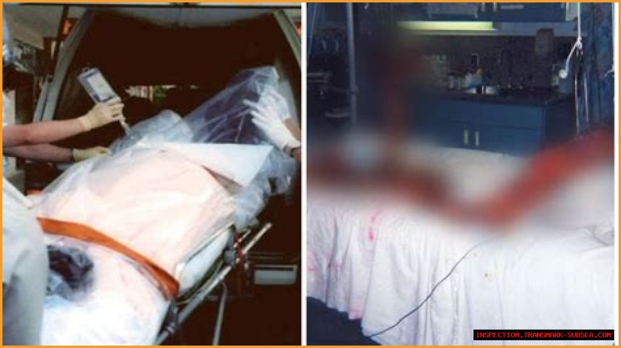 Unraveling The Mystery Behind Hisashi Ouchi Photo