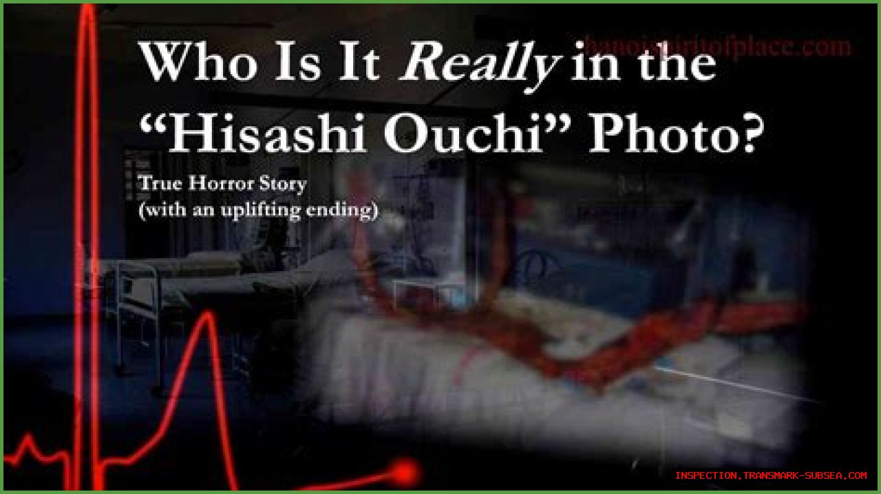 Unraveling The Mystery Of Hisashi Ouchi's Corpse: A Journey Through Tragedy And Science