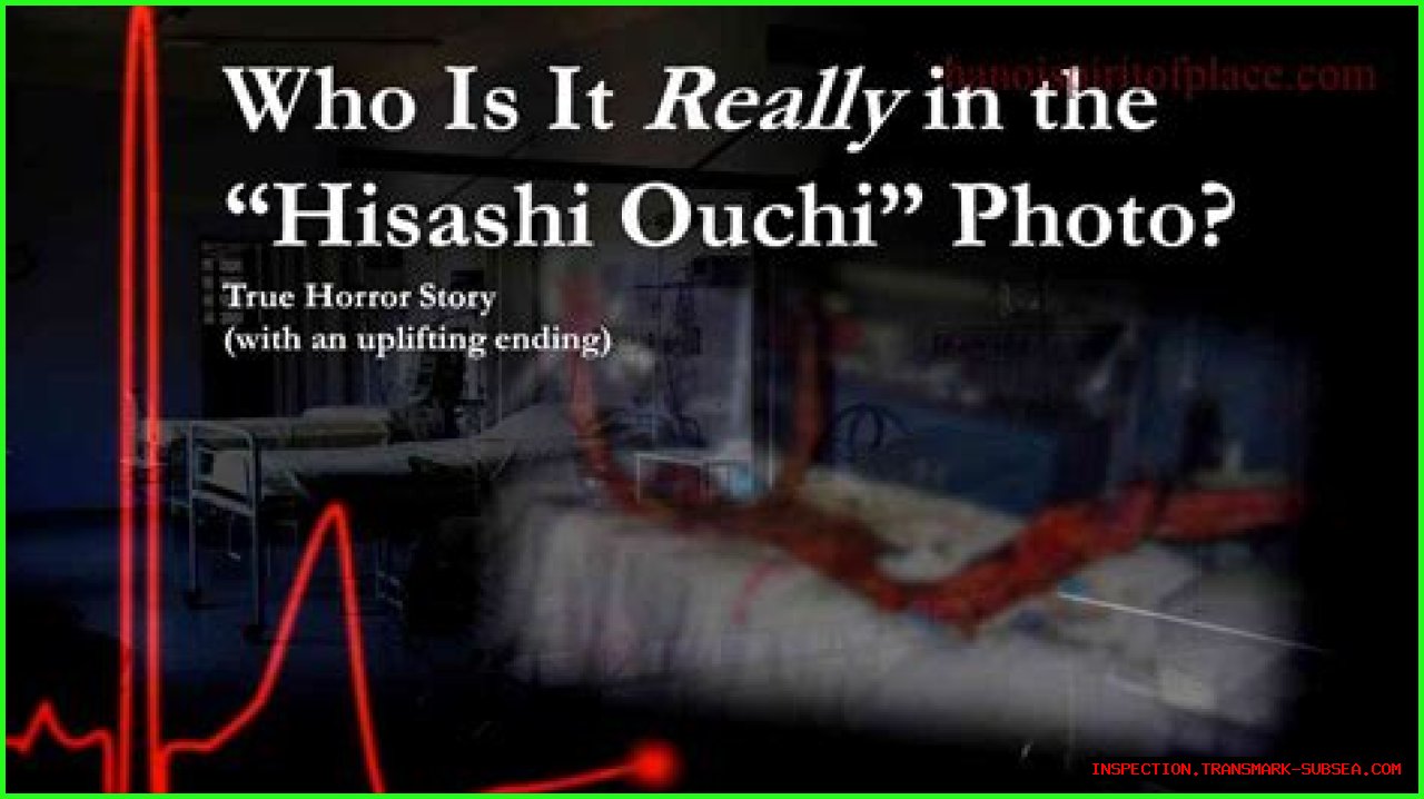 Unraveling The Mystery Of Hisashi Ouchi's Real Body